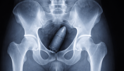 Vil&aacute;gh&aacute;bor&uacute;s bomb&aacute;val a segg&eacute;ben jelentkezett az &uuml;gyeleten, az eg&eacute;sz k&oacute;rh&aacute;zat ki kellett &uuml;r&iacute;teni