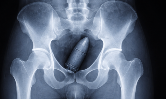 Vil&aacute;gh&aacute;bor&uacute;s bomb&aacute;val a segg&eacute;ben jelentkezett az &uuml;gyeleten, az eg&eacute;sz k&oacute;rh&aacute;zat ki kellett &uuml;r&iacute;teni